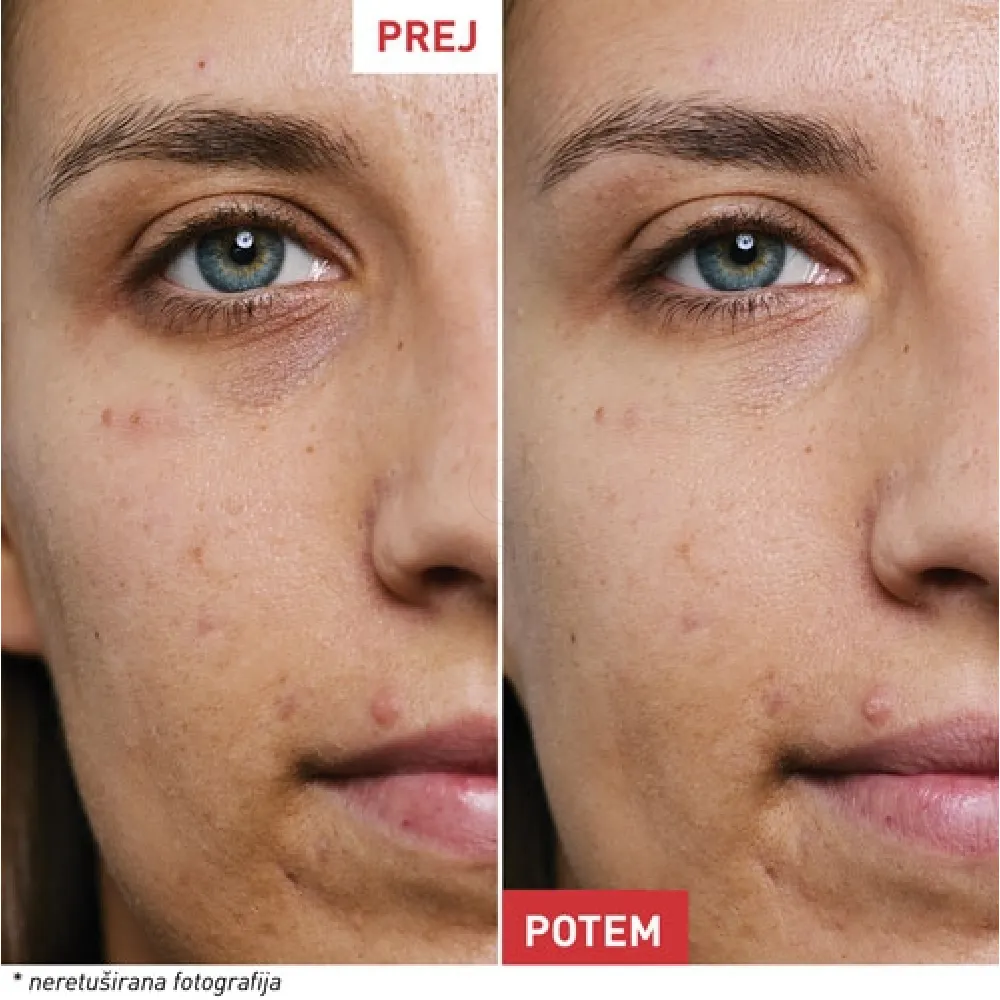 Erborian Skin Therapy Eye, nočna krema za področje okoli oči  (15 ml)